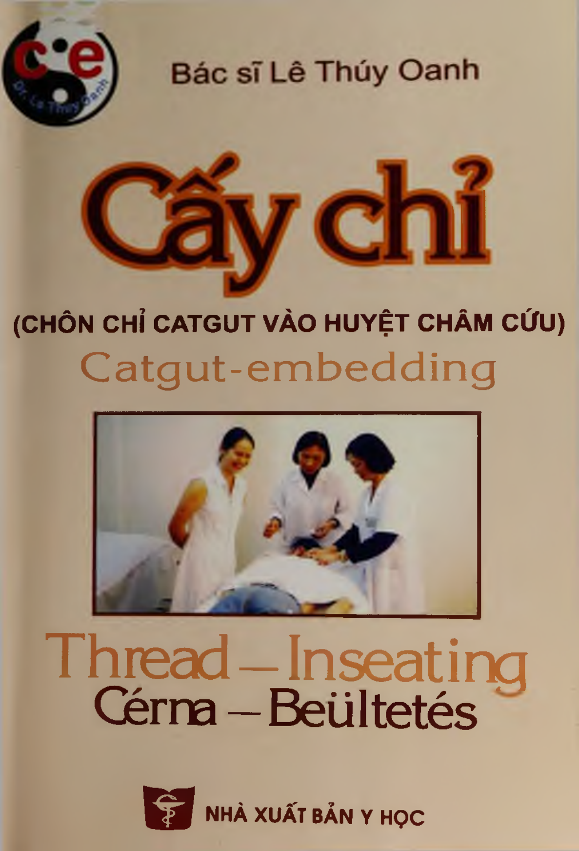 Cấy chỉ (chôn chỉ catgut vào huyệt châm cứu)